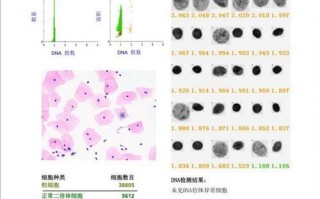 医学检验报告单模板-医学检验报告系统模板