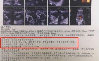 腹部超声检查报告单怎么看 腹部超声报告模板