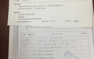 普通b超化验单模板,b超化验单怎么看 