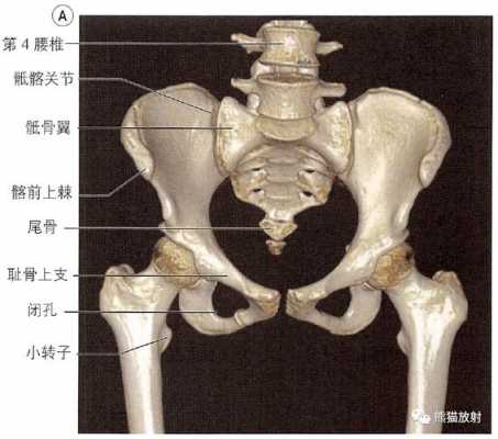 骨盆x片诊断报告模板_骨盆x光片各部位图解-第2张图片-马瑞范文网