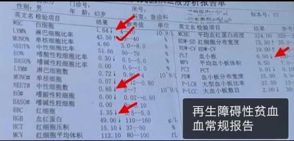 血腥化验单模板,血样化验单怎么看懂讲解 -第3张图片-马瑞范文网