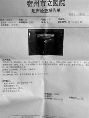 腹部超声检查报告单怎么看 腹部超声报告模板-第3张图片-马瑞范文网