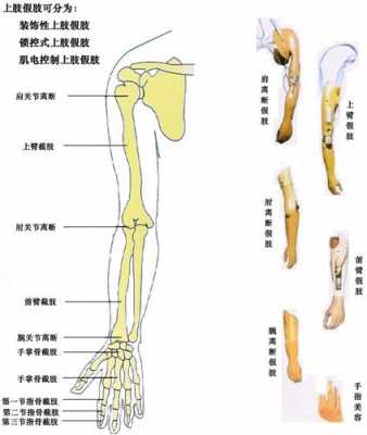 上肢假肢制作步骤-上肢假肢处方模板-第1张图片-马瑞范文网