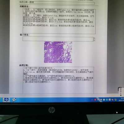 病理报告有模板吗-第2张图片-马瑞范文网