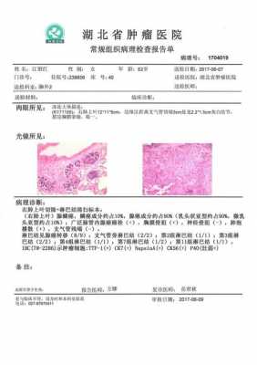 病理报告有模板吗-第3张图片-马瑞范文网